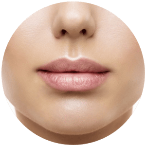Lip-Flip-treatment